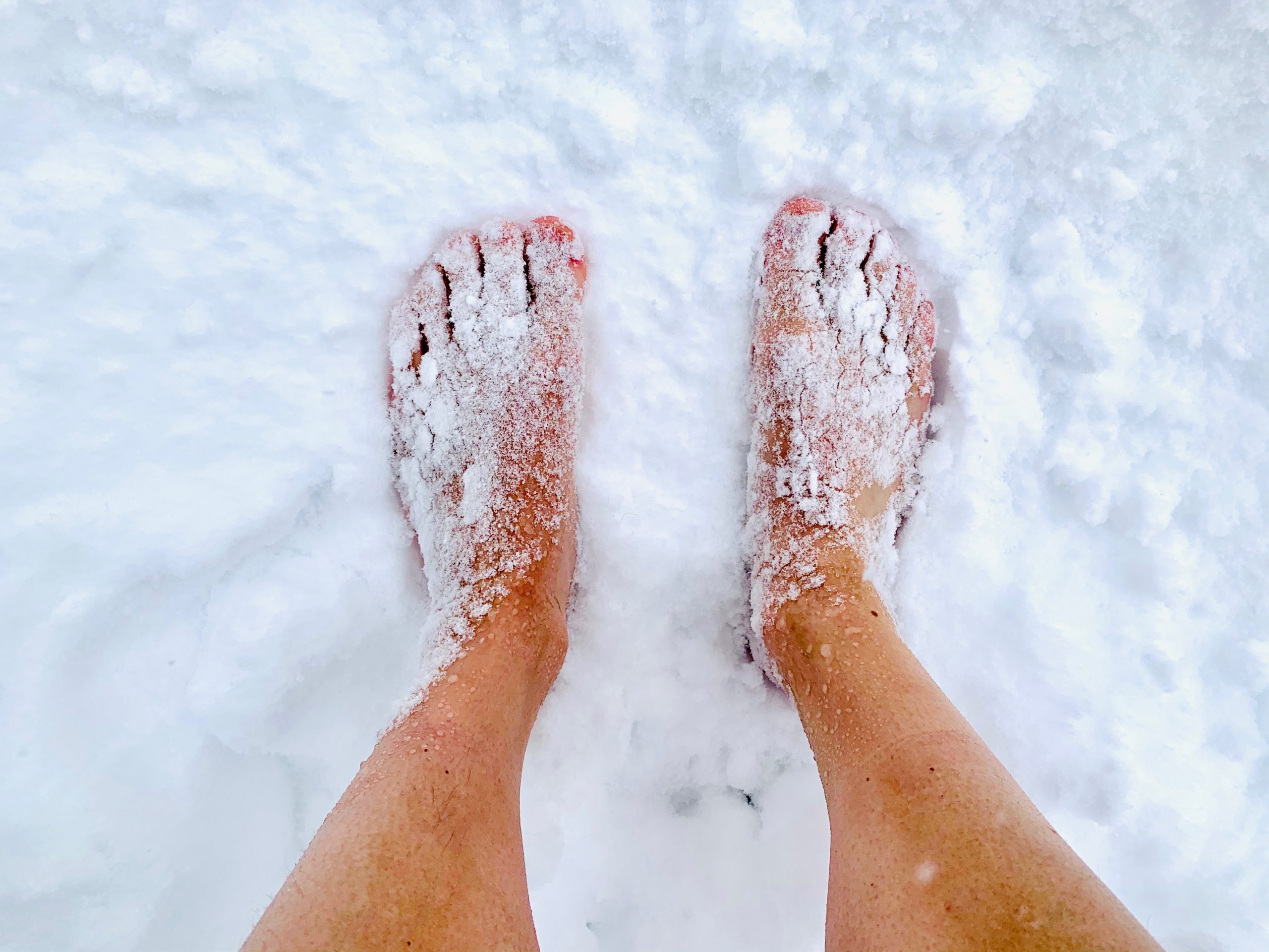 Foot and Ankle Injury in Winter - West Bay Foot & Ankle